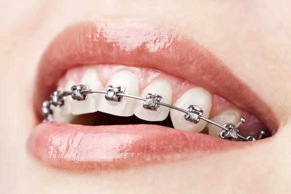 Thrive Dental and Orthodontics Dallas for Complete Family Care